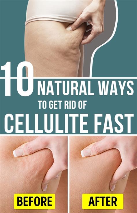 cul cellulite|how to reduce cellulite fast.